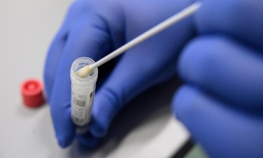 نمونه گیری صحیح، کلید طلایی در انجام دادن آزمایش پی سی آر نمونه گیری صحیح، کلید طلایی در انجام دادن آزمایش پی سی آر