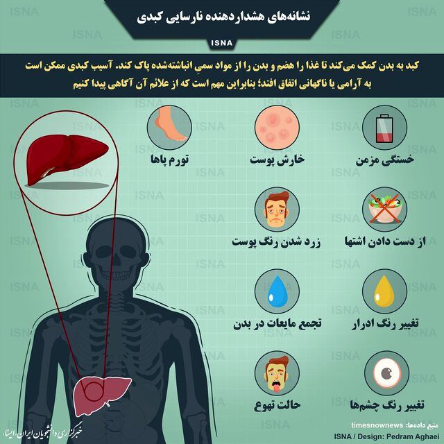 نشانه‌های نارسایی کبدی+اینفوگرافی