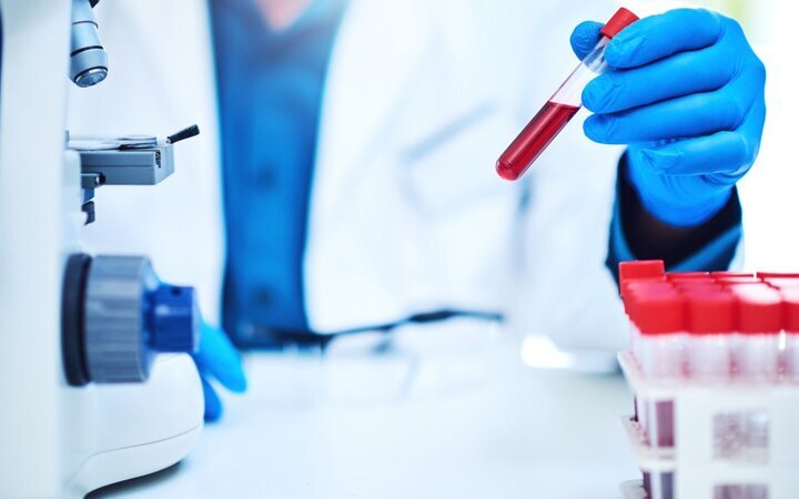 تشخیص سریع چندین پاتوژن با ساخت تراشه گرافنی